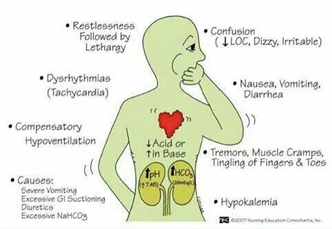 <ul><li><p>high pH, high HCO3</p></li><li><p>restlessness, tachycardia, confusion, tremors, muscle cramps</p></li><li><p>causes: severe vomiting, excessive GI suctioning, diuretics, excessive NaHCO3</p></li></ul>
