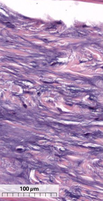 <p>What type of cartilage is in this tendon and how can you tell?</p>