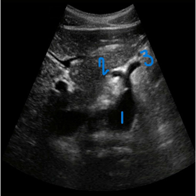 <p>In this transverse view, what is #2?</p>