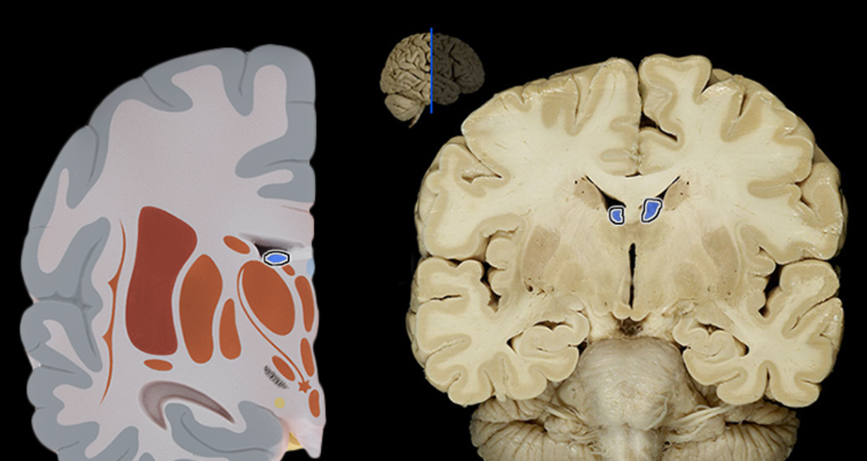 <p>Choroid plexus</p>