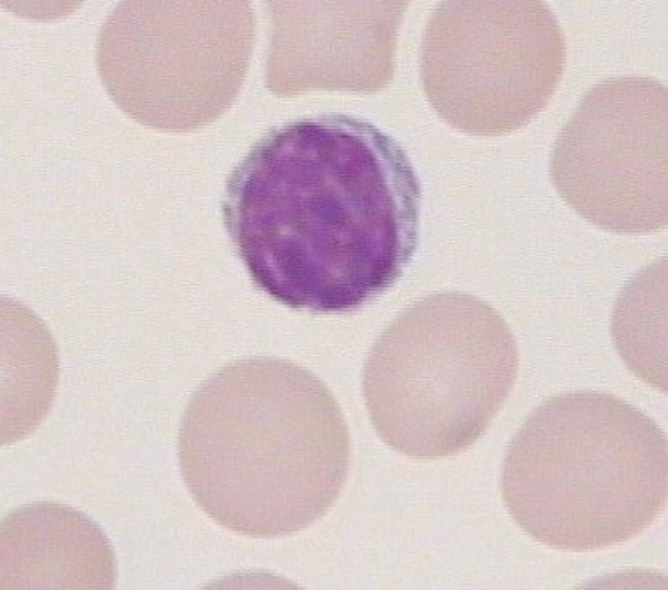 <p>Lymphocytes</p>