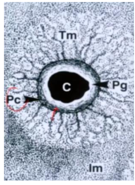 <p>-2 chondrocytes lying close together</p><p>-communicating with surrounding lacuna wall that has pericellular capsule (basket fibers)</p><p>-immediately around cells there’s a glycocalyx (Pg), pericellular capsule (Pc), territorial matrix with collagen fibers (Tm, inner matrix is lighter stain whereas outer matrix is darker stain)</p>
