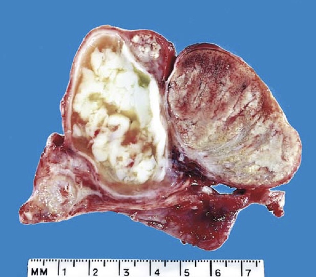 term image
