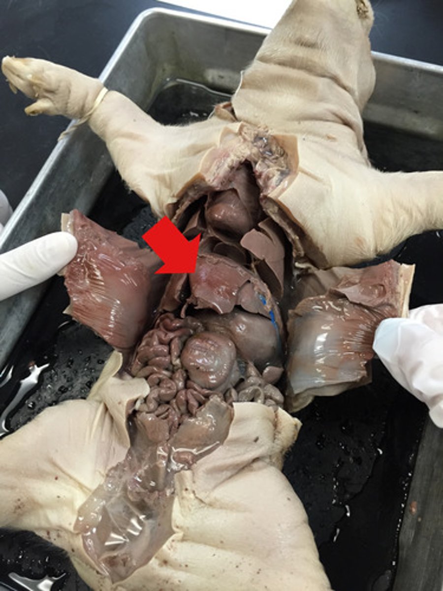 <p>name this organ</p>