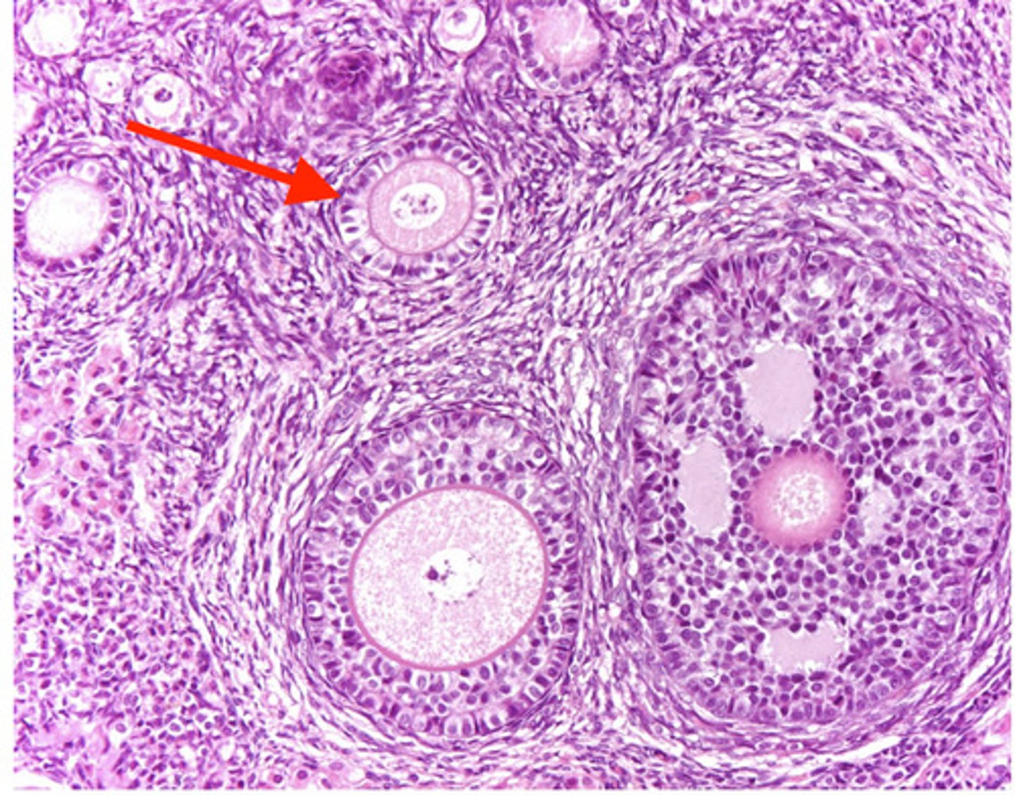 <p>what type of follicle?</p>