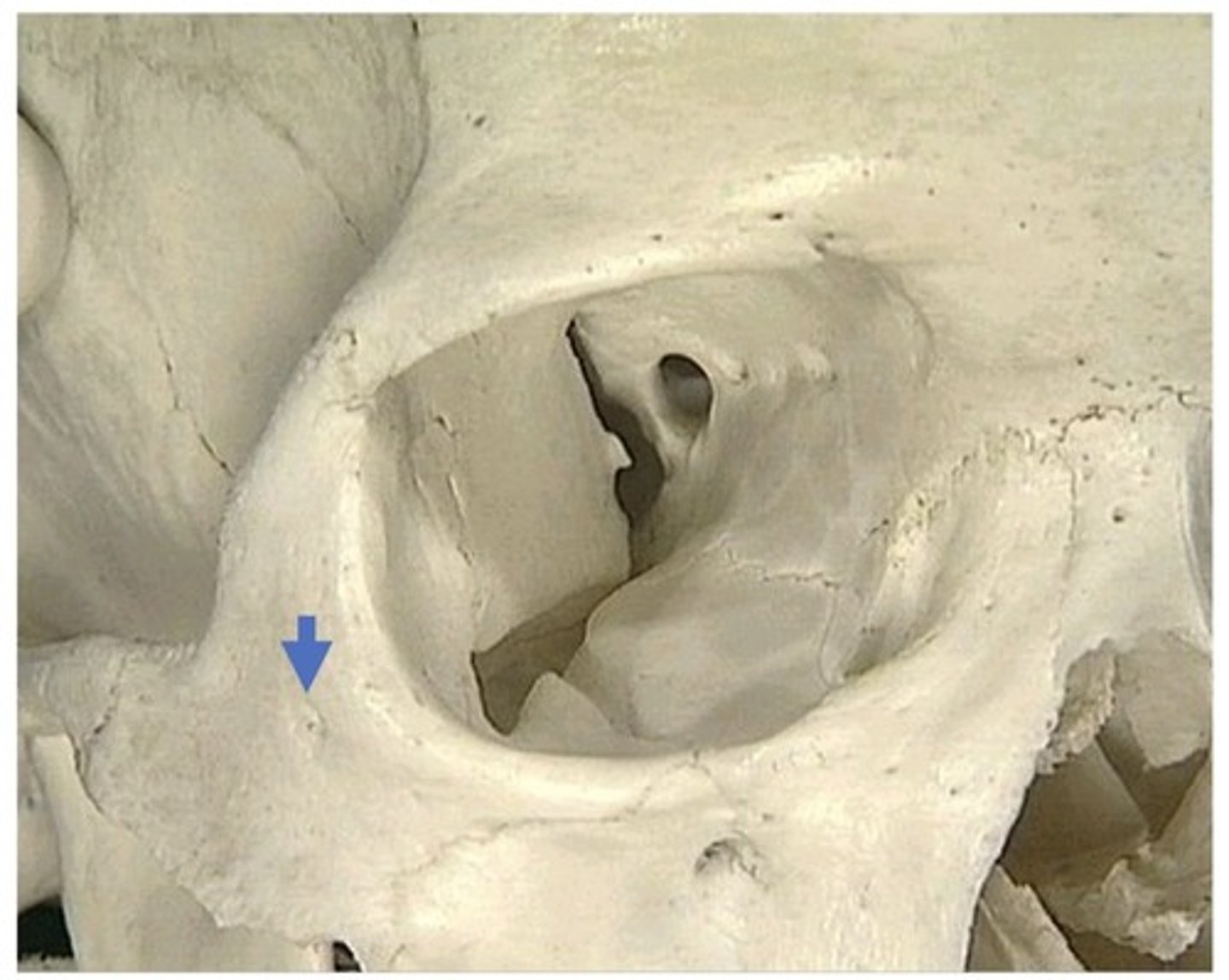 <p>1. In zygomatic bone, on the face</p><p>2. There are 2 more small foramen like this</p>
