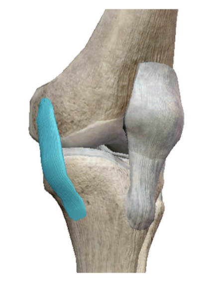 <p>Name the ligament</p>