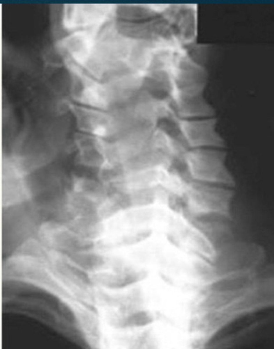 <p>What projection view is this?</p>