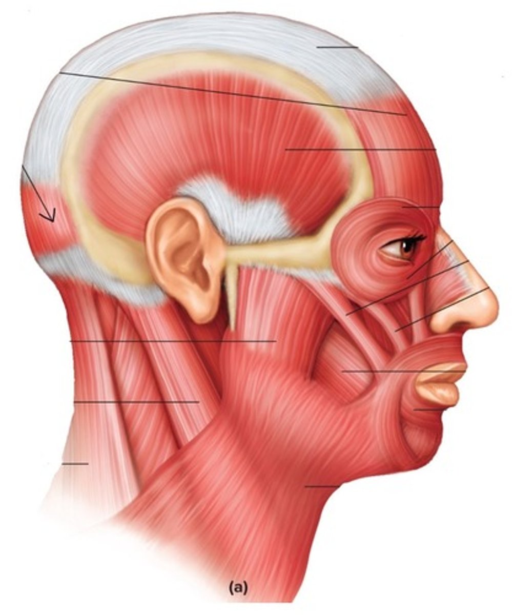 <p>What muscle is this?</p>