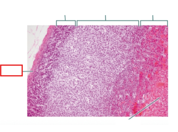 <p>What structure is highlighted?</p>