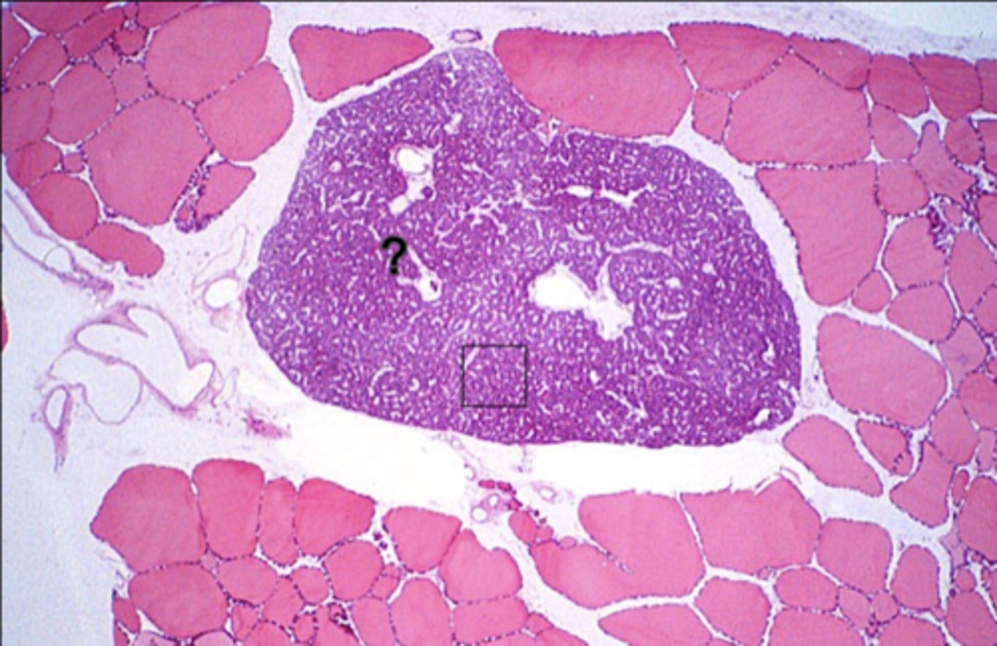 <p>What is the ? indicating?</p>