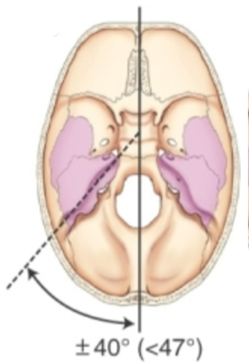 <p>long narrow skull</p><p>-width is less than 75% of length</p>