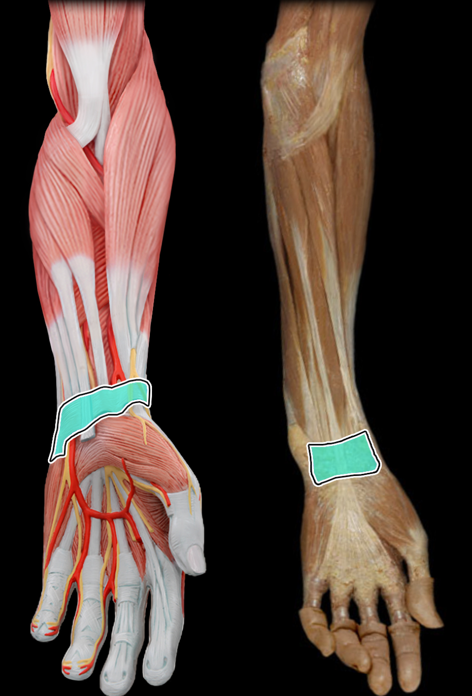 knowt flashcard image