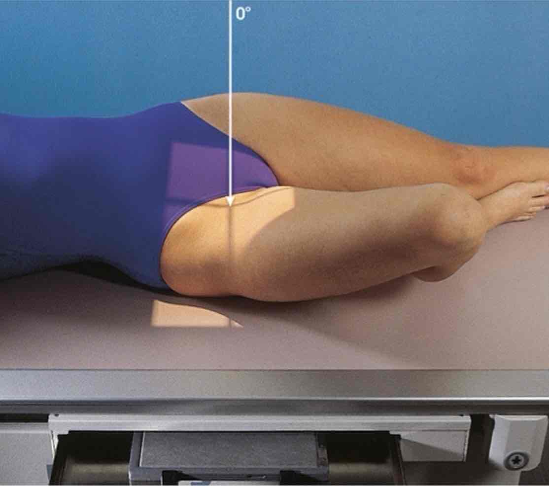 <p>What Projection is this?</p>