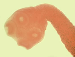 <p>four large suckers, adult worms are flat and long</p>