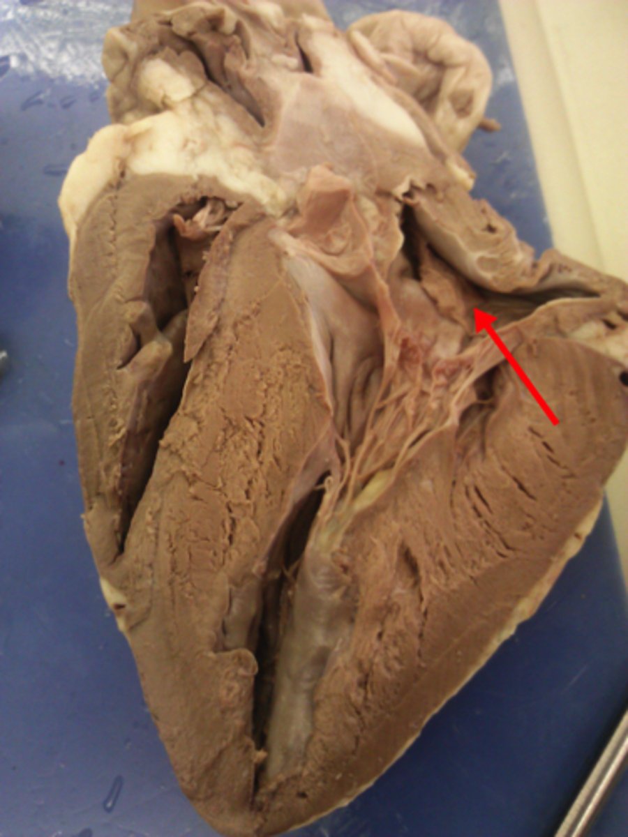 <p>What is the chamber the green box pointing to?</p>