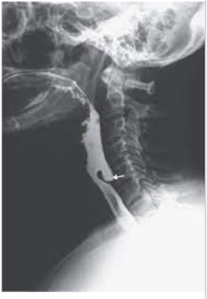 <p>What is this </p>