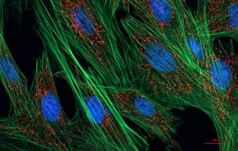 Fluorescence microscopy