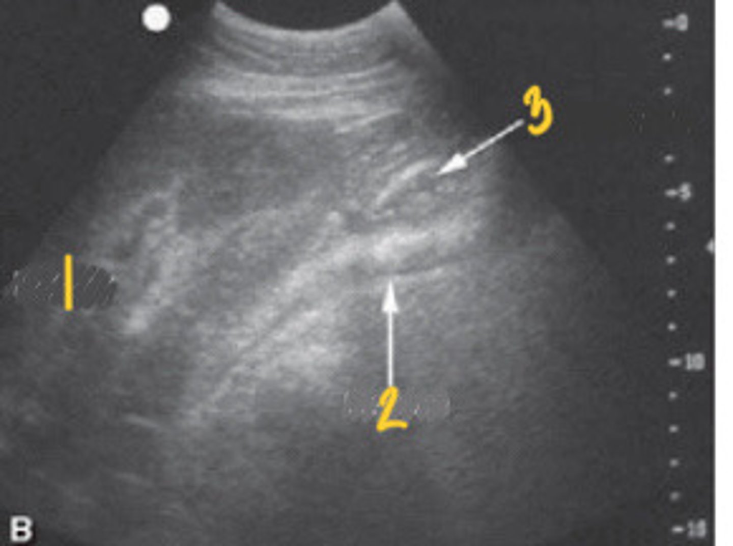 <p>What FLASH view is this in horses and what are the numbers showing you?</p>