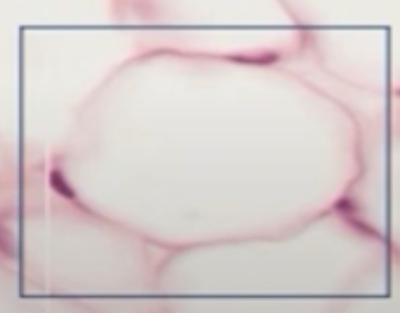 <p>Identify the cell.</p><ul><li><p>note the <em>Signet Ring </em>shape </p></li><li><p>note that the nucleus is located <strong>peripherally</strong></p></li></ul><p></p>