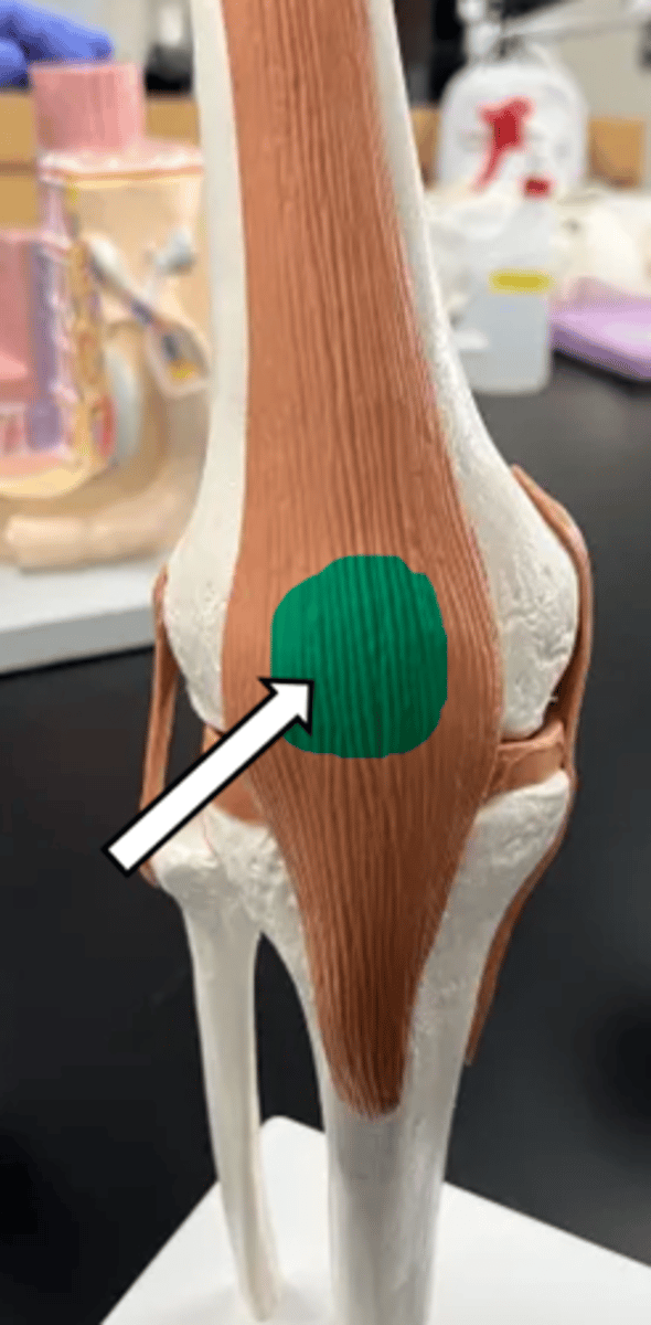 <p>name the articulation/joint</p>
