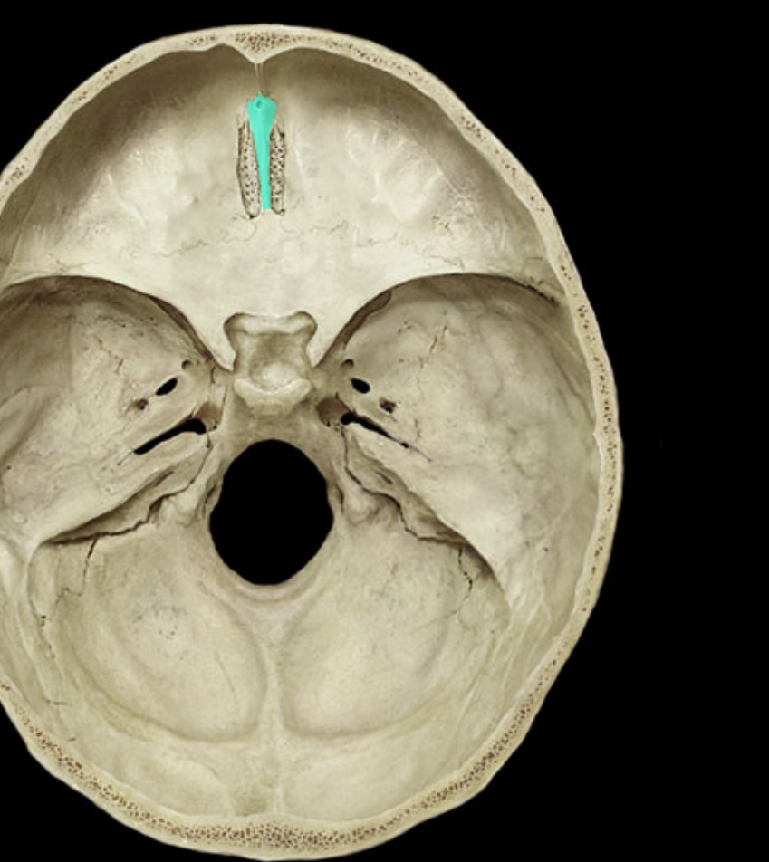 <p>what is highlighted/ Ethmoid </p>