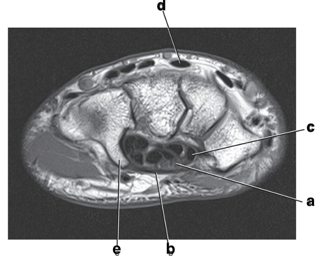 <p>What is letter e?</p>