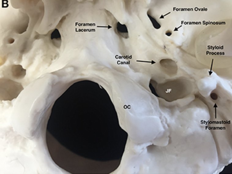 <ul><li><p><strong>Foramen ovale</strong></p></li><li><p>Openings located posterolateral to the foramen rotundum </p></li><li><p>A brancg of cranial nerve V (mandibular division) passes through </p></li></ul><p></p>