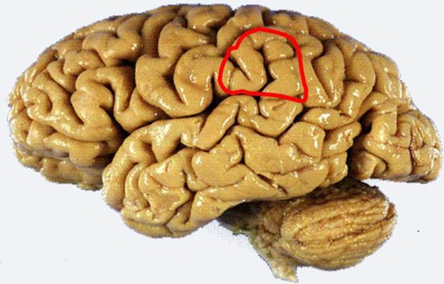 <p>part of inferior parietal lobulus</p>