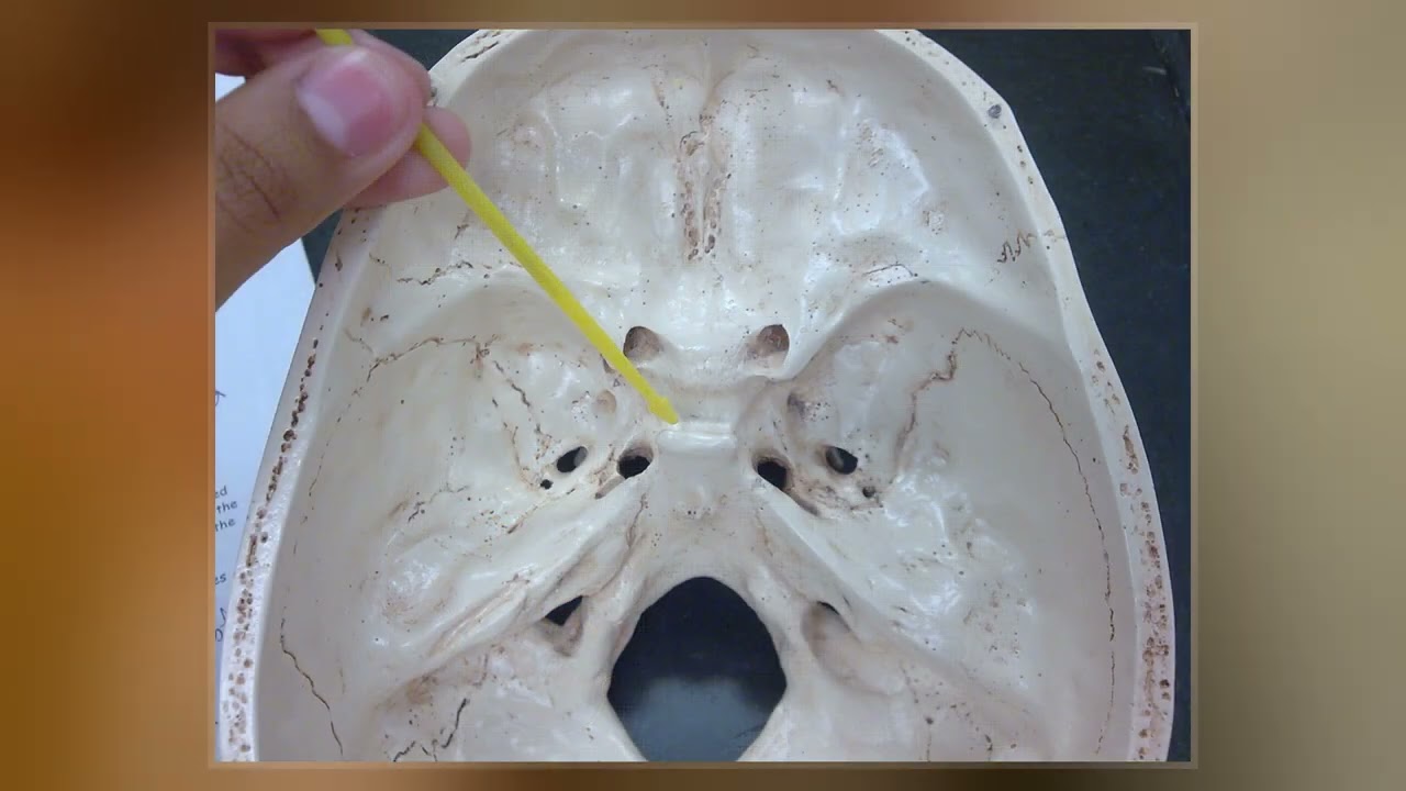 <p>depression that hold the pituitary gland (inside the skull)</p>