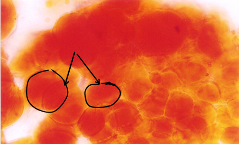 <p>THOSE TWO BLACK ARROWS ARE POINTING</p>