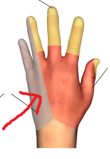<p>The area where the red arrow is pointing is what dermatomal nerve? </p>