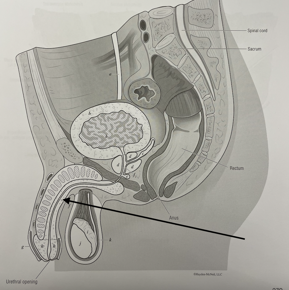 <p>what structure is this</p>