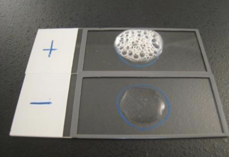 <p>Hydrogen peroxide </p><p>Catalase = hydrogen peroxide → O2 = bubbles </p><p>2H2O2 --catalase→ 2H2O + O2</p>