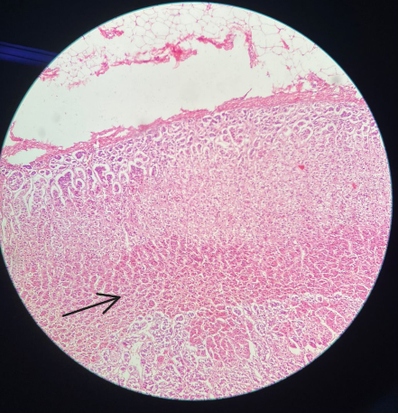 Capa