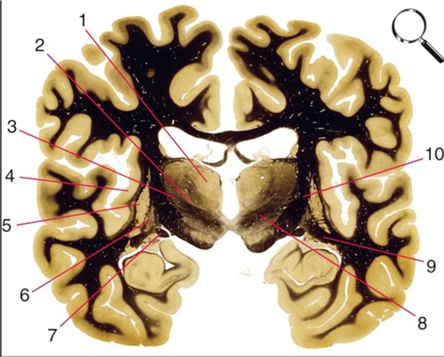 <p>5 and 6</p>