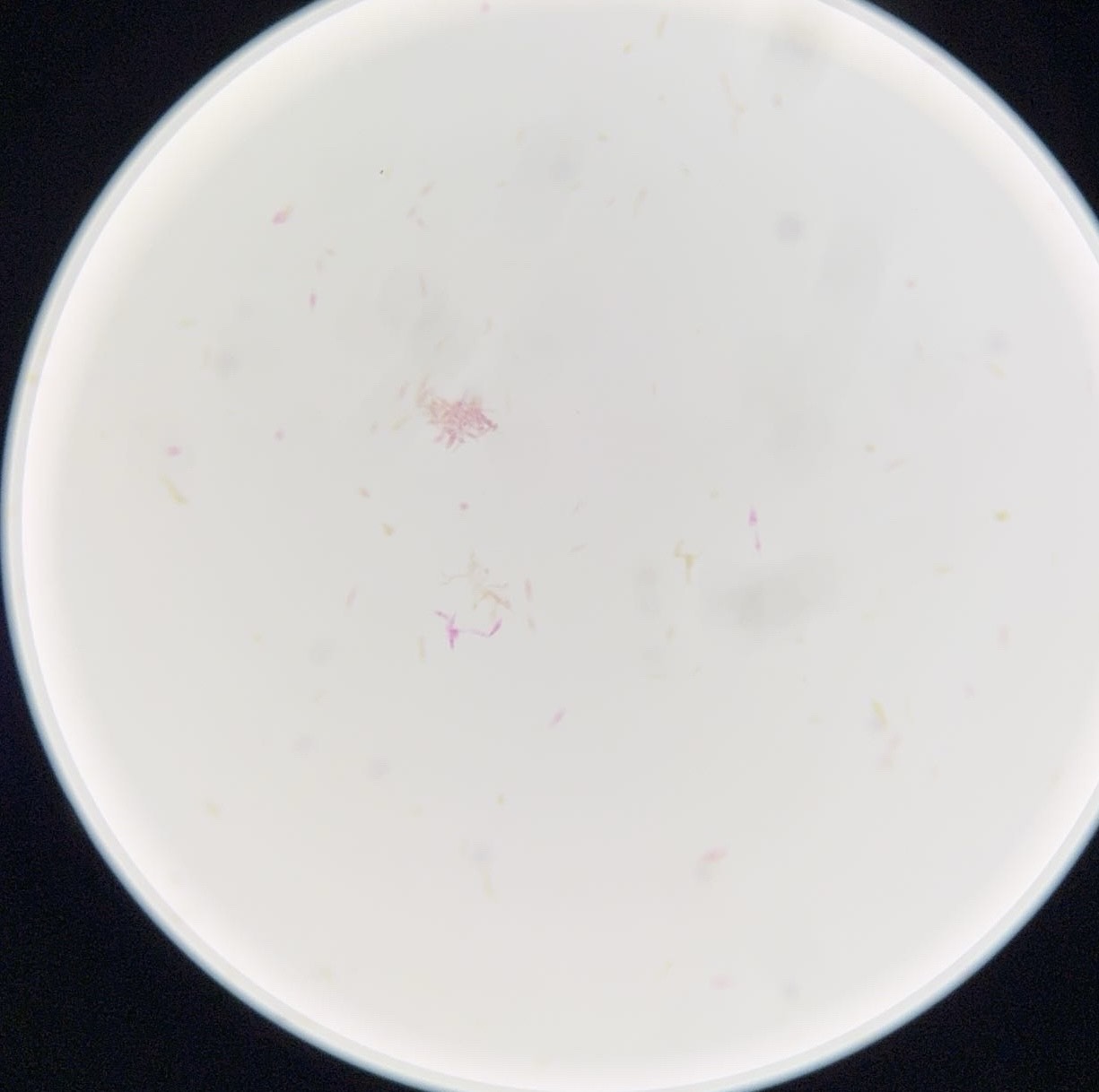 <p><span>What is this organism?</span></p>