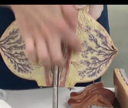 <p>Description: Conical-shaped fat pad</p><p>Relationship: Contains mammary glands</p>