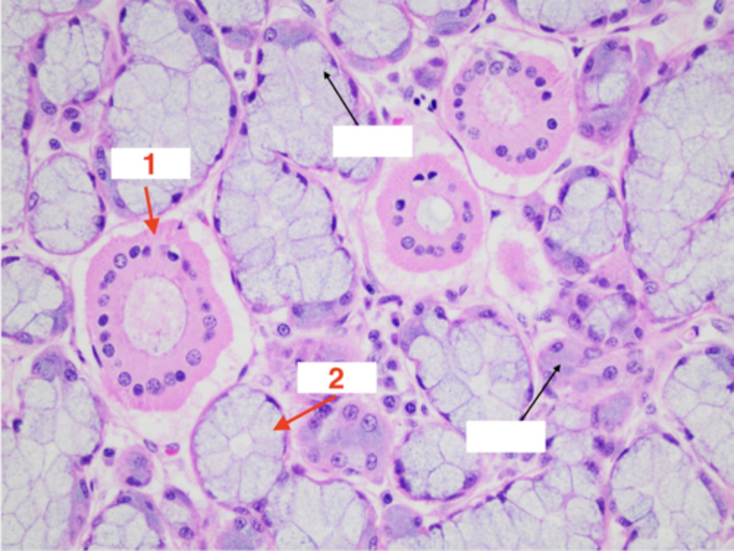 <p>What structure is this tissue part of?</p>