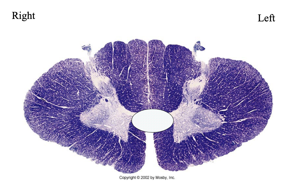 <p>What clinical findings would you expect with each of these lesions?</p>