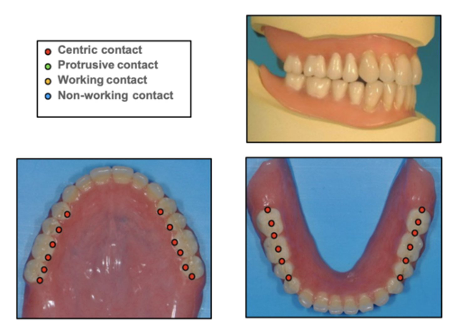 <p>This is what occlusal scheme?</p>