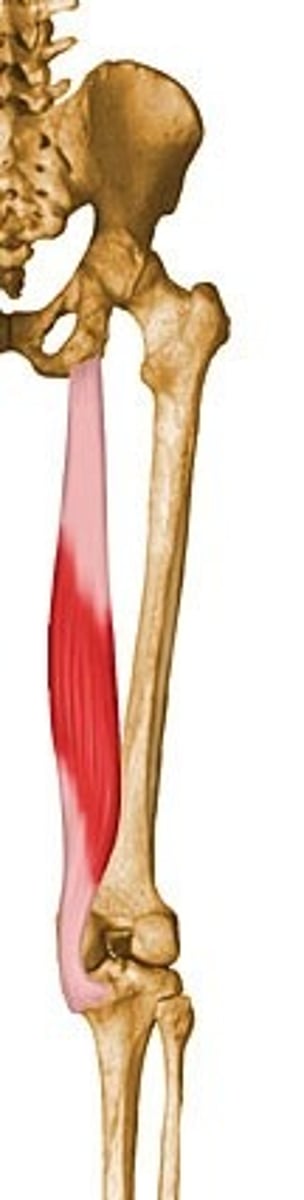 <p>What muscle is this?</p>