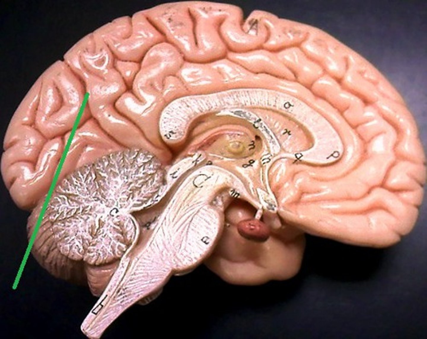 <p>Separates parietal and occipital lobes</p>