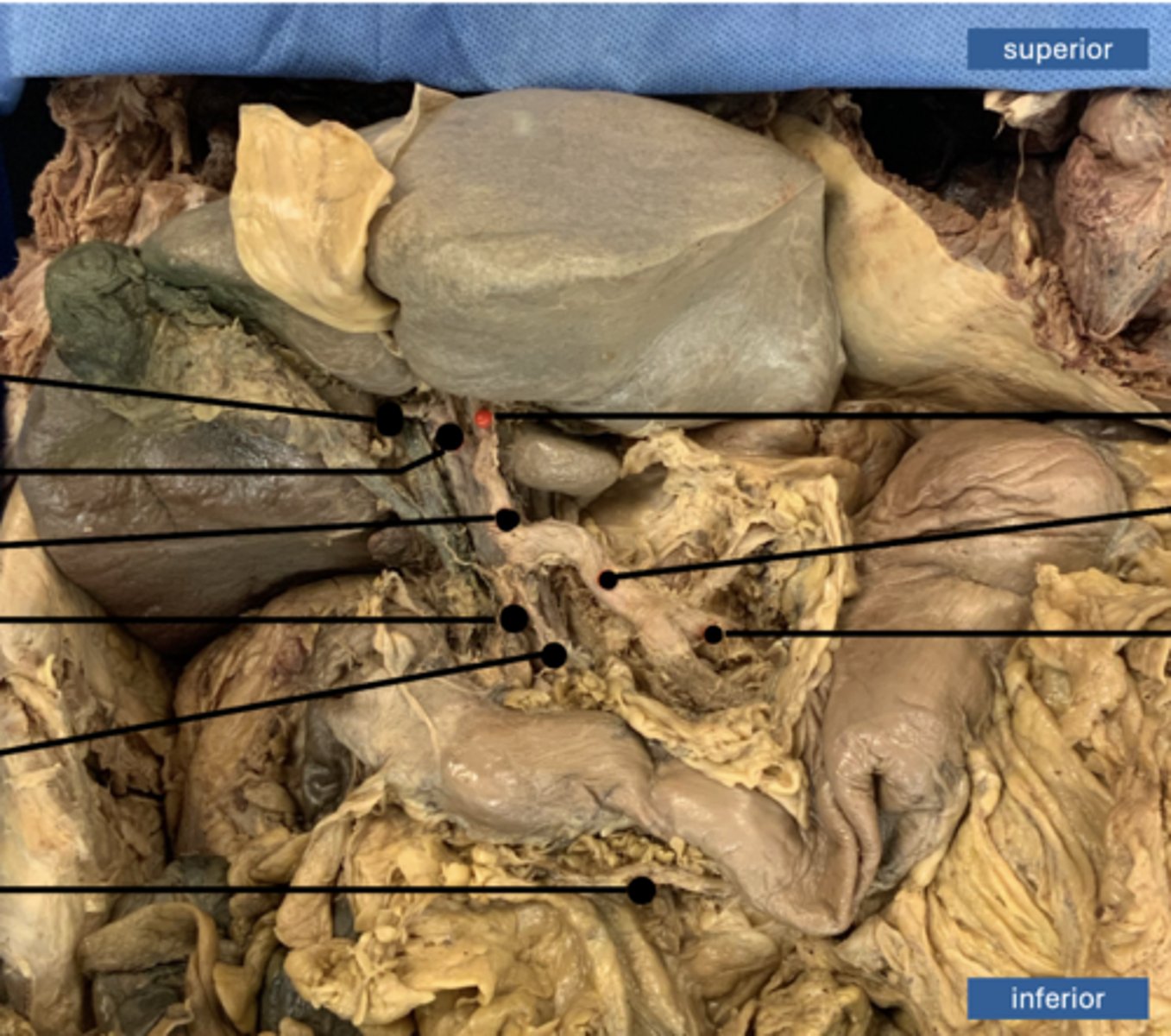 <p>artery</p>