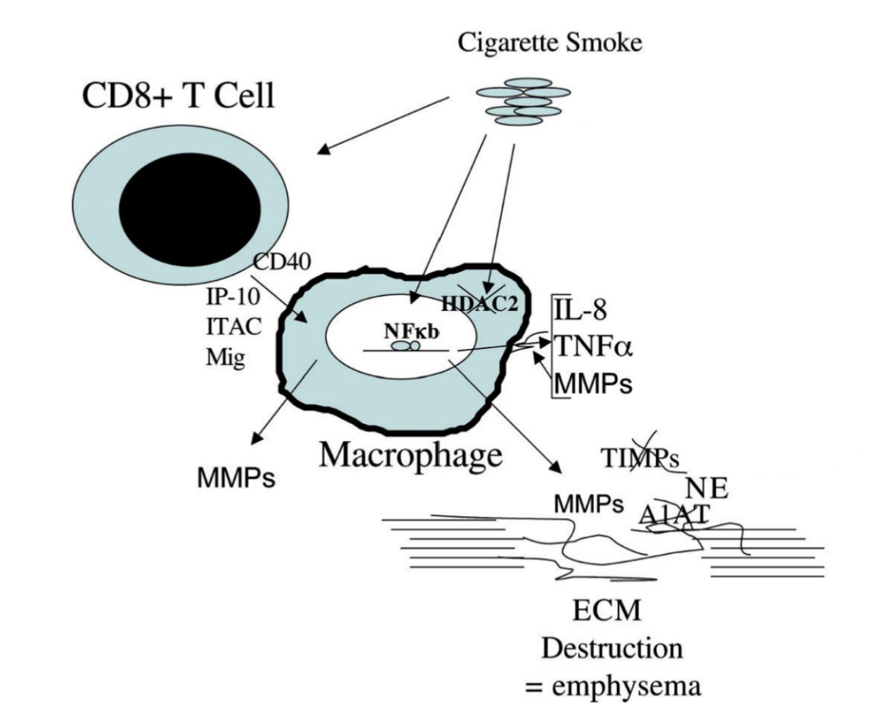 <p>Cigarette smoke → activates T cells → induction of macrophage production of MMPs via CD40 stimulation</p><p>Cigarette smoke also inactivates HDAC2 → NF-kB mediated transcription of inflammatory cytokines (TNF-alpha, IL-8) and MMP (protease) </p><p>MMPs and neutral elastase degrade eachother’s inhibitors (TMP and A1AT) → altered ECM degrading capacity (more ECM destruction) → emphysema </p>