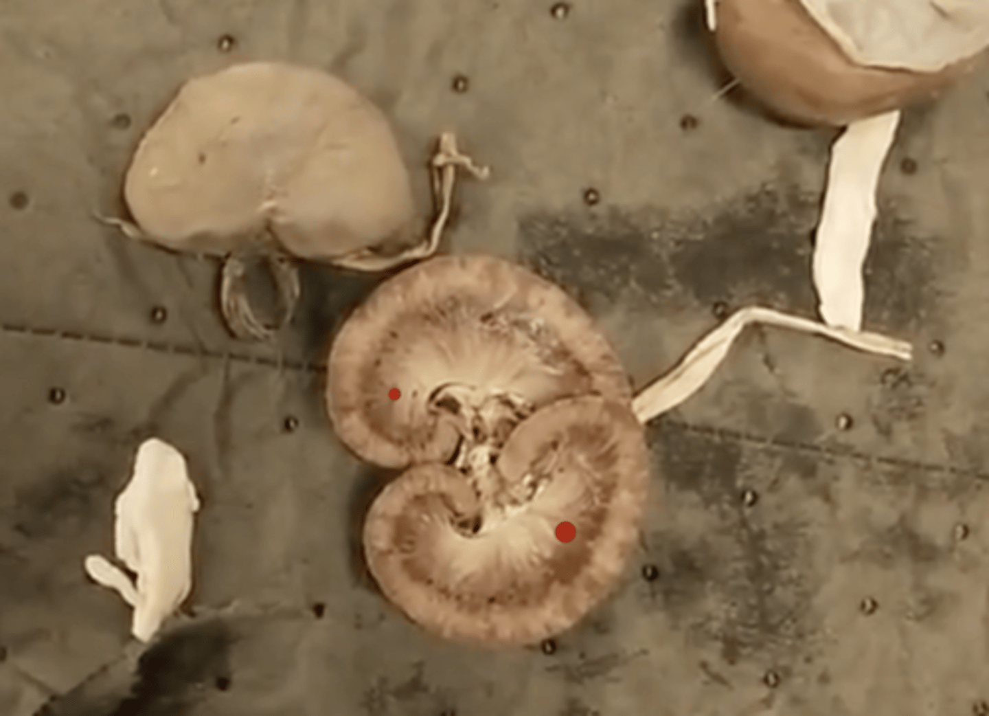 <p>DEFINITION</p><p>Inner layer of the kidney containing loops of Henle and collecting ducts</p>