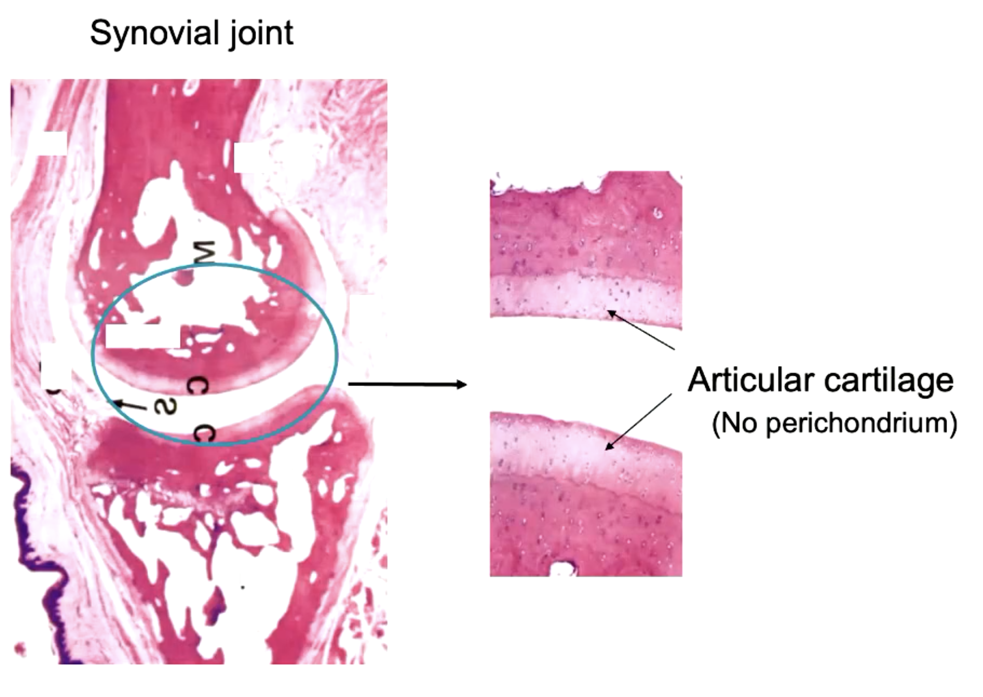<p>articular cartilage (no perichondrium)</p>