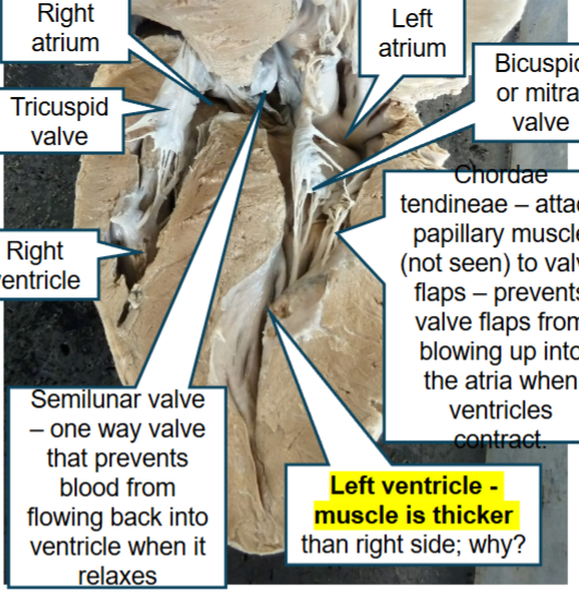 <p>Because it pumps blood out into the systemic circuit</p>