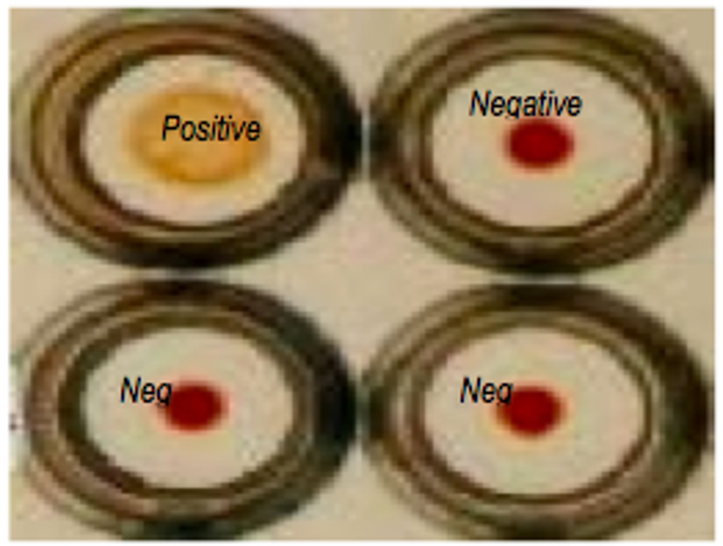 <p>Assay for Syphilis that is excellent in resolving inconclusive FTA-ABS results</p>