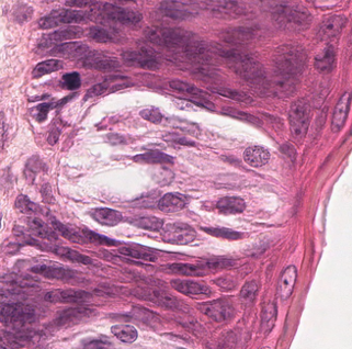 <p><span>•Oval-shaped</span></p><p><span>•Taste pore</span></p><p><span>–Opening into the surface</span></p><p><span>•Sensory cells</span></p><p><span>•Support cells</span></p><p><span>•Location</span></p><p><span>–Lingual papillae</span></p><p><span>–Oral cavity</span></p><p><span>•Glossopharyngeal arch</span></p><p><span>•Soft palate</span></p><p><span>•Epiglottis</span></p>